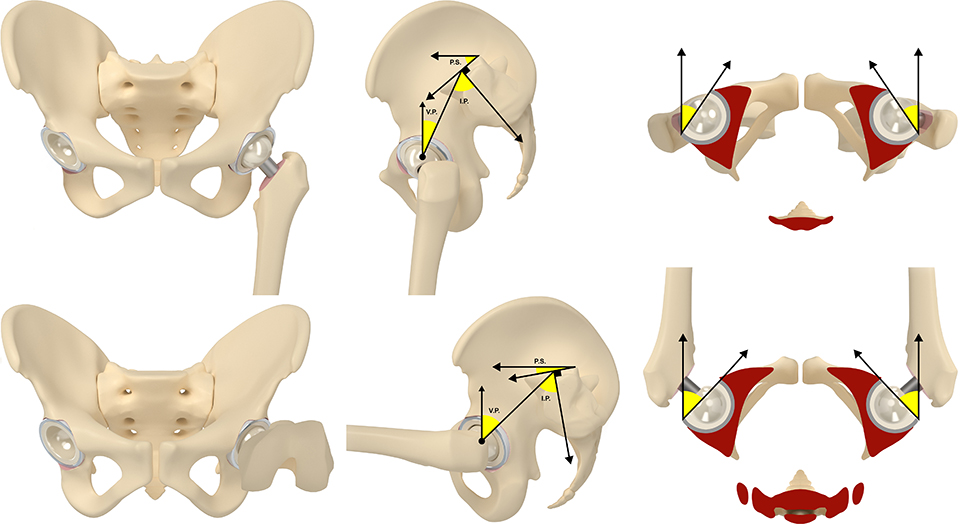 illustration médicale