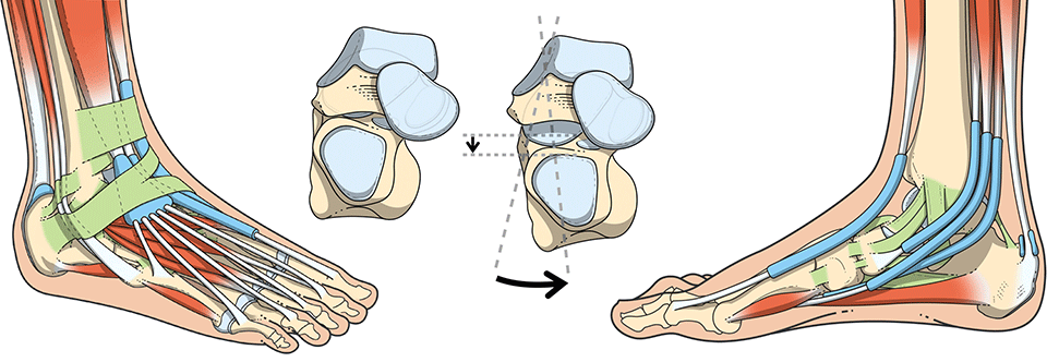 illustration médicale