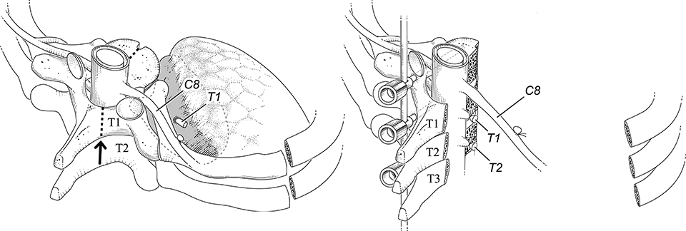 illustration médicale